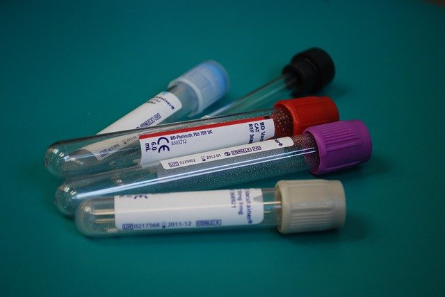 laboratoř, vzorky krve